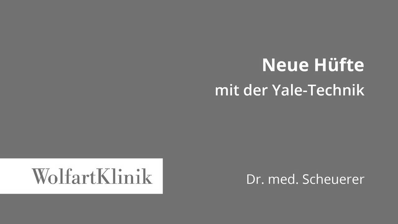 New hip for {pain|ache} {using|utilizing} the minimally invasive Yale {technique|method|approach}